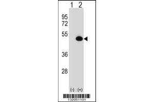 Western blot analysis of ASS1 using rabbit polyclonal ASS1 Antibody using 293 cell lysates (2 ug/lane) either nontransfected (Lane 1) or transiently transfected (Lane 2) with the ASS1 gene. (ASS1 antibody  (C-Term))