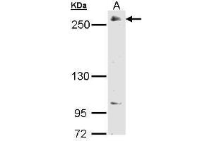 WB Image Sample (30 ug of whole cell lysate) A: 293T 5% SDS PAGE antibody diluted at 1:2000 (POLR2A/RPB1 antibody  (C-Term))