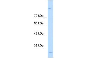 MPPED2 antibody used at 0. (MPPED2 antibody  (C-Term))