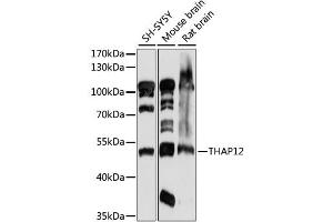 Western blot analysis of extracts of various cell lines, using THAP12 antibody (ABIN6292038) at 1:1000 dilution. (PRKRIR antibody)