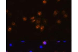 Immunofluorescence analysis of L929 cells using SWAP70 Polyclonal Antibody at dilution of 1:100. (SWAP70 antibody)