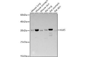 Western blot analysis of extracts of various cell lines, using KLK5 antibody (ABIN3017128, ABIN3017129, ABIN3017130, ABIN1680614 and ABIN6219971) at 1:500 dilution. (Kallikrein 5 antibody)