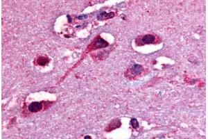 Anti-Delta Opioid Receptor antibody  ABIN1048498 IHC staining of human brain, neurons and glia.