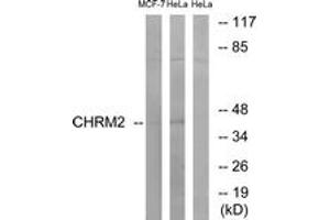 Western blot analysis of extracts from HeLa/MCF-7 cells, using CHRM2 Antibody. (Muscarinic Acetylcholine Receptor M2 antibody  (AA 185-234))