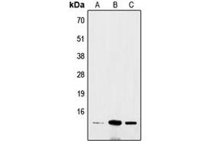 Western blot analysis of BRI3 expression in Hela (A), mouse brain (B), rat colon (C) whole cell lysates. (BRI3 antibody  (N-Term))