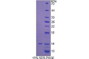 Image no. 1 for Procollagen-Lysine, 2-Oxoglutarate 5-Dioxygenase 3 (PLOD3) (AA 647-738) protein (His tag) (ABIN4990202)
