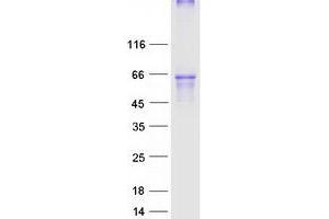 Validation with Western Blot