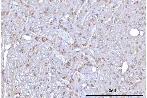 IHC analysis of RAP1GAP using anti-RAP1GAP antibody (ABIN7599729). (RAP1GAP antibody  (AA 11-661))