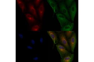 ABIN6265844 and ABIN6276978 staining  cells by IF/ICC.