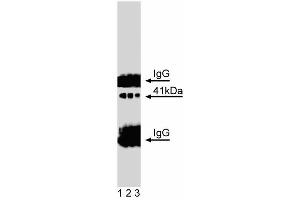 Western blot analysis of Doublecortin on a mouse neonate lysate. (Doublecortin antibody  (AA 211-317))