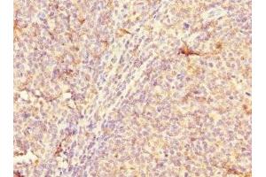 Immunohistochemistry of paraffin-embedded human tonsil tissue using ABIN7147978 at dilution of 1:100 (CD3A (AA 18-180) antibody)