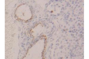 DAB staining on IHC-P; Samples: Rat Ovary Tissue (KRT4 antibody  (AA 317-454))