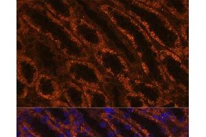 Immunofluorescence analysis of Rat kidney using LAMC2 Polyclonal Antibody at dilution of 1:100 (40x lens). (LAMC2 antibody)