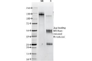SDS-PAGE Analysis of Purified Catenin, beta Mouse Monoclonal Antibody (12F7).