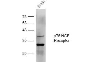 Mouse brain lysates probed with Anti-p75 NGF Receptor Polyclonal Antibody  at 1:5000 90min in 37˚C.