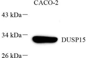 Western blot analysis of DUSP15 (ABIN7073774) at dilution of 1: 1000 (DUSP15 antibody)