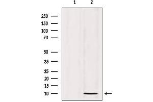 Western blot analysis of extracts from 293, using SPINK1 Antibody. (SPINK1 antibody  (Internal Region))