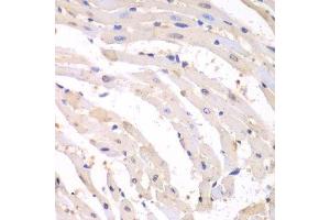 Immunohistochemistry of paraffin-embedded mouse heart using PSMB1 antibody. (PSMB1 antibody  (AA 29-241))