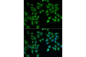 Immunofluorescence analysis of A549 cells using FLOT2 antibody (ABIN5973960). (Flotillin 2 antibody)