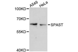 Western blot analysis of extracts of various cell lines, using SPAST antibody (ABIN5996162) at 1:3000 dilution. (Spastin antibody)