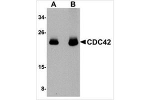 Western blot analysis of CDC42 in human brain tissue lysate with CDC42 antibody at (A) 0. (CDC42 antibody  (N-Term))