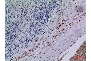 Immunohistochemistry (IHC) analysis of paraffin-embedded Human Brain, antibody was diluted at 1:100. (CXCR3 antibody  (Internal Region))