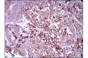 Immunohistochemistry (IHC) image for anti-Synaptonemal Complex Protein 3 (SYCP3) (AA 27-128) antibody (ABIN1724891)
