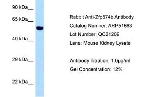 WB Suggested Anti-Zfp874b Antibody   Titration: 1. (Chitinase antibody  (Middle Region))