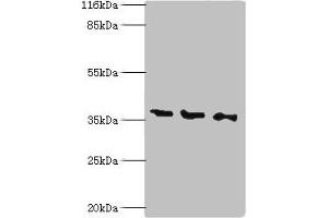 Western blot All lanes: N-acetyl-D-glucosamine kinase antibody at 2 μg/mL Lane 1: HepG2 whole cell lysate Lane 2: 293T whole cell lysate Lane 3: Hela whole cell lysate Secondary Goat polyclonal to rabbit IgG at 1/10000 dilution Predicted band size: 38, 43 kDa Observed band size: 38 kDa (NAGK antibody  (AA 2-344))