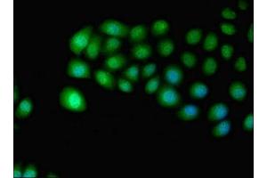 Immunofluorescent analysis of A549 cells using ABIN7156211 at dilution of 1:100 and Alexa Fluor 488-congugated AffiniPure Goat Anti-Rabbit IgG(H+L) (IDO2 antibody  (AA 1-407))