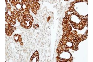 IHC-P Image Immunohistochemical analysis of paraffin-embedded N87 xenograft, using RAP2C, antibody at 1:100 dilution. (RAP2C antibody)