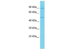 Host: Rabbit Target Name: ANKRD10 Sample Type: U937 Whole Cell lysates Antibody Dilution: 1. (ANKRD10 antibody  (C-Term))