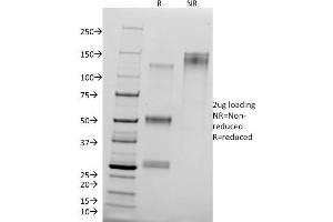 SDS-PAGE Analysis of Purified CTNND1 Mouse Monoclonal Antibody (25a). (CTNND1 antibody)