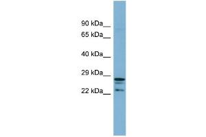 WB Suggested Anti-CUTC  Antibody Titration: 0. (CUTC antibody  (Middle Region))
