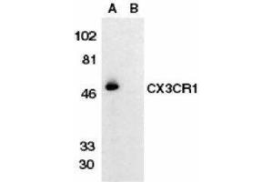 Western Blotting (WB) image for anti-Chemokine (C-X3-C Motif) Receptor 1 (CX3CR1) antibody (ABIN2473127) (CX3CR1 antibody)