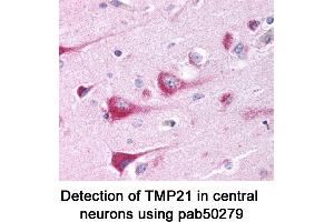 Image no. 1 for anti-Transmembrane Emp24-Like Trafficking Protein 10 (TMED10) (AA 100-200) antibody (ABIN363588) (TMED10 antibody  (AA 100-200))