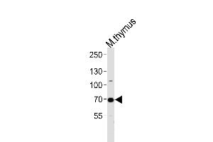 Western blot analysis of lysate from mouse thymus tissue lysate, using Mouse Ephb6 Antibody (Center) (ABIN1881301 and ABIN2838401). (EPH Receptor B6 antibody  (AA 503-530))