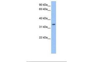 Image no. 1 for anti-Lactamase, beta (LACTB) (AA 250-299) antibody (ABIN6738832) (LACTB antibody  (AA 250-299))