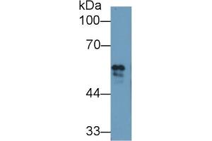 Detection of FGB in Bovine Serum using Polyclonal Antibody to Fibrinogen Beta Chain (FGB) (Fibrinogen beta Chain antibody  (AA 49-495))