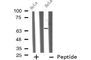 Western blot analysis GRK4 using HeLa whole cell lysates (GRK4 antibody  (N-Term))