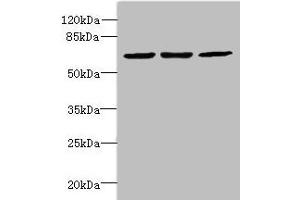 Western blot All lanes: INTS11 antibody at 2 μg/mL Lane 1: Colo320 whole cell lysate Lane 2: Hela whole cell lysate Lane 3: MCF-7 whole cell lysate Secondary Goat polyclonal to Rabbit IgG at 1/10000 dilution Predicted band size: 68, 57, 66, 65, 69 kDa Observed band size: 68 kDa (CPSF3L antibody  (AA 331-600))