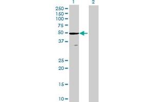Western Blot analysis of ZCCHC3 expression in transfected 293T cell line by ZCCHC3 MaxPab polyclonal antibody. (ZCCHC3 antibody  (AA 1-403))