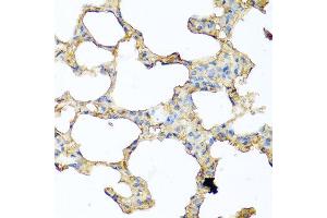 Immunohistochemistry of paraffin-embedded mouse lung using PIP antibody at dilution of 1:100 (40x lens). (PIP antibody)