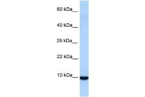 WB Suggested Anti-Id3 Antibody Titration: 1. (ID3 antibody  (Middle Region))