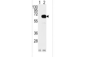 Western blot analysis of SD4 Antibody (arrow) using rabbit polyclonal SD4 Antibody  (ABIN392165 and ABIN2841882). (SMAD4 antibody  (AA 255-284))