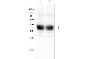 Western blot analysis of CD8A using anti-CD8A antibody (ABIN6719524). (CD8 alpha antibody  (AA 27-114))