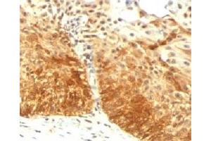 Immunohistochemistry (IHC) image for anti-Keratin 14 (KRT14) (C-Term) antibody (ABIN3024621)