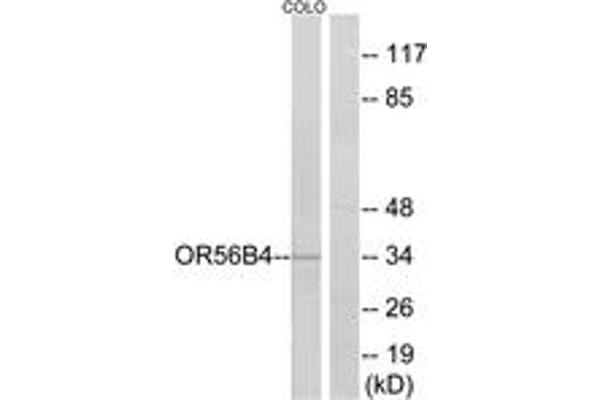 OR56B4 抗体  (AA 241-290)