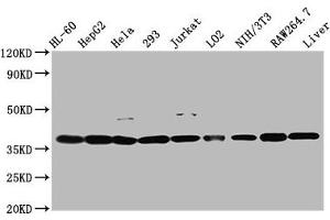 Western Blot Positive WB detected in: HL60 whole cell lysate, HepG2 whole cell lysate, Hela whole cell lysate, 293 whole cell lysate, Jurkat whole cell lysate, LO2 whole cell lysate, NIH/3T3 whole cell lysate, RAW264. (MDH1 antibody  (AA 1-334))