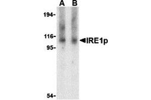 Western Blotting (WB) image for anti-Endoplasmic Reticulum To Nucleus Signaling 1 (ERN1) (Middle Region) antibody (ABIN1030962) (ERN1 antibody  (Middle Region))